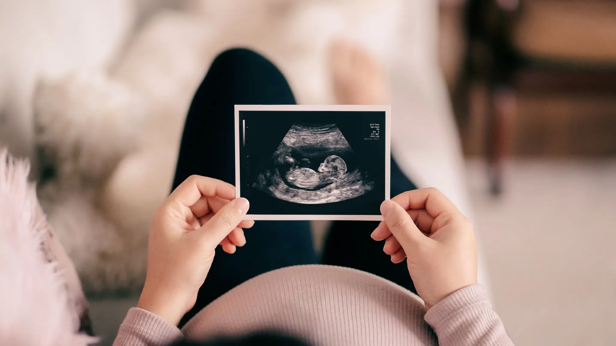 Gravid mave og scanningsbillede